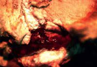 キャストからしみ出している